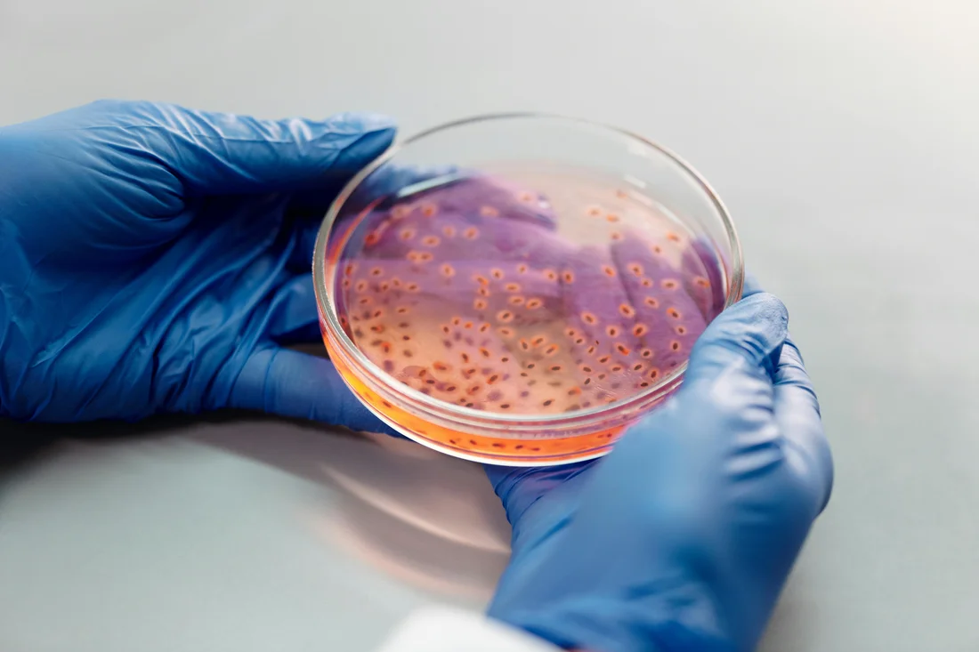 a close-up of a person's gloved hands holding a petri dish with an orange culture inside
